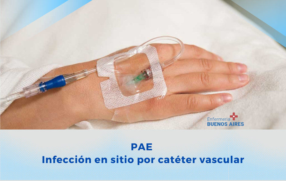 PAE – Infección del sitio catéter vascular