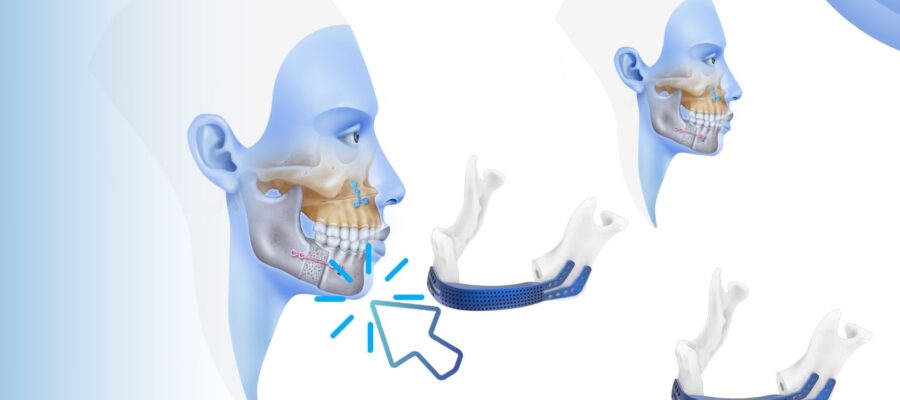 Reconstrucción mandibular por lesión de agente químico
